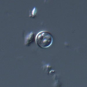 Figure A: Oocyst of <em>C. cayetanensis</em> viewed under differential interference contrast (DIC) microscopy. The refractile globules are easily visible under DIC.