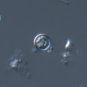 Figure D: Oocyst of <em>C. cayetanensis</em> viewed under DIC microscopy.