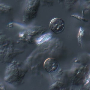 Figure E: A pair of oocysts of <em>C. cayetanensis</em> viewed under DIC microscopy.