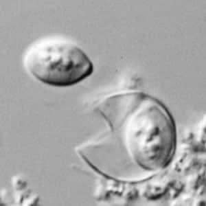 Figure F: Rupturing oocyst of <em>C. cayetanensis</em> viewed under DIC microscopy. One sporocyst has has been released from the mature oocyst; the second sporocyst is still contained within the oocyst wall.