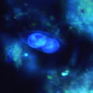 Figure D: Oocyst of <em>C. belli</em> viewed under ultraviolet (UV) microscopy, showing two sporoblasts.