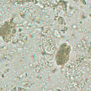 Figure A: Immature oocyst of C. belli stained with safranin, containing a single sporoblast.