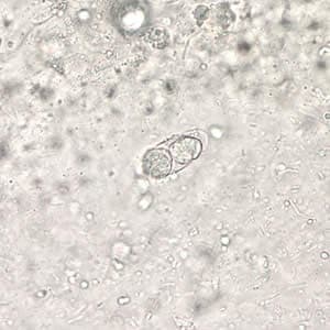 Figure B: Immature oocyst of <em>C. belli</em> in an unstained wet mount showing two sporoblasts.