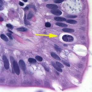 Figure A: Oocyst of <em>C. belli</em> in the epithelial cells of a mammalian host, stained with H&E (yellow arrow). 