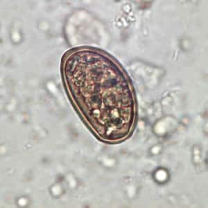 fascioliasis dicroceliosis májparaziták kezelése