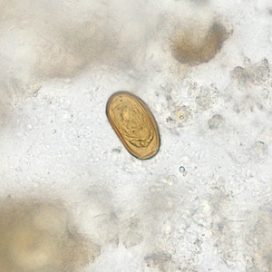 Figure D: Egg of <em>D. dendriticum</em> in an unstained wet mount of stool.
