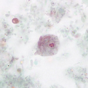 Figure B: Uninucleate form of a trophozoite of <em>D. fragilis</em>, stained with trichrome.