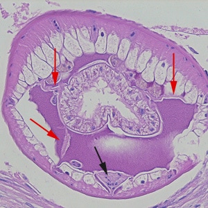 Figure E: Higher-magnification of the specimens shown in Figures A-D. Shown in this image are the tall, polymyarian muscle cells, the characteristic ventral chord with a U-shaped row of nuclei (black arrow), and three pseudocoelomic membranes (red arrows).