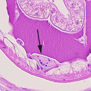 Figure F: Close-up of Figure A, showing the ventral chord (black-arrow).