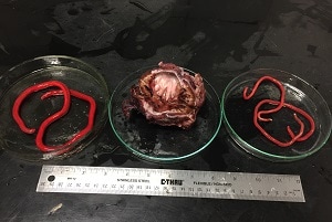 Figure A: One <em>D. renale</em> female (left) and two males (right) extracted from the kidney of a naturally infected dog. 