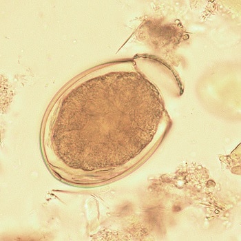 diphyllobothriasis parazitológia