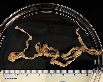 parazitákra fújni Escherichia coli kenetben férfiaknál