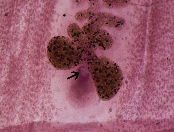 diphyllobothriasis Helix giardia infection contagious