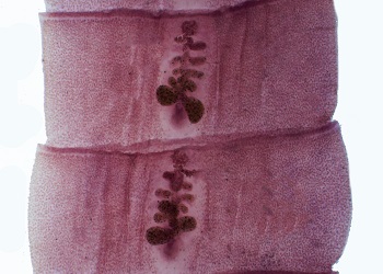 Proglattids CDC - DPDx - Diphyllobothriasis