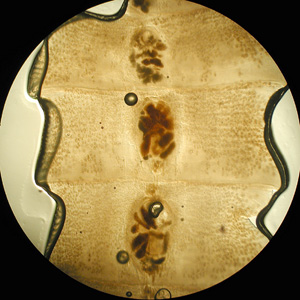 Proglottids Model CDC - DPDx - Diphyllobothriasis