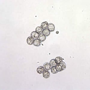 Figure A: <em>D. caninum</em> eggs clumped together in a wet mount. Image taken at 200x magnification.