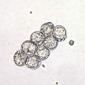 Figure B: <em>D. caninum</em> eggs clumped together in a wet mount. Image taken at 400x magnification, hooklets in the some of the eggs are visible.