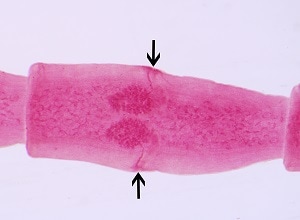 Figure D: <em>D. caninum</em> proglottid. The genital pores are clearly visible in the carmine-stained proglottid.
