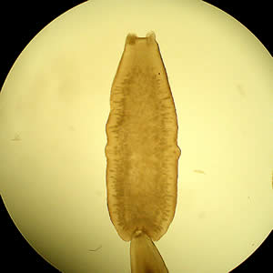 Figure A: <em>D. caninum</em> proglottid under a dissecting microscope cleared with lactophenol.