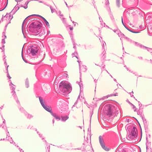 Figure C: Cross-section of a <em>D. caninum</em> proglottid stained with H&E. Image taken at 400x magnification