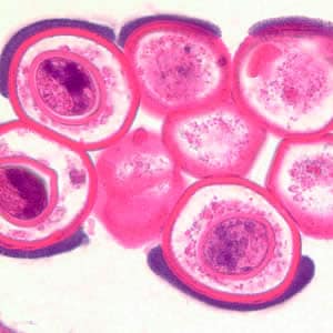 Figure D: Cross-section of a <em>D. caninum</em> proglottid stained with H&E. Image taken at 1000x magnification.