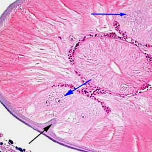 Figure D: The same specimen as Figure C, at 400x magnification. Note the presence of lateral chords (blue arrows) and internal lateral ridge (black arrow).