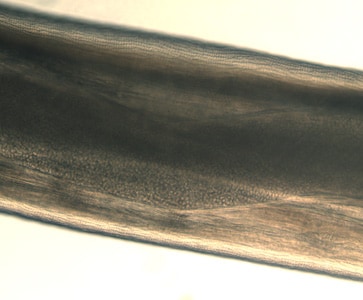 Figure F: Close-up of the specimen in Figure E showing the cuticular ridging. A uterine tube can also be seen through the cuticle.