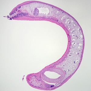 Figure A: Adult <em>Echinostoma</em> removed during a colonoscopy, stained with hematoxylin and eosin (H&E). 
