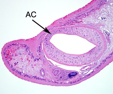 Figure B:Higher magnification of the anterior end of the specimen in Figure A. Notice the acetabulum (ventral sucker,  AC). 