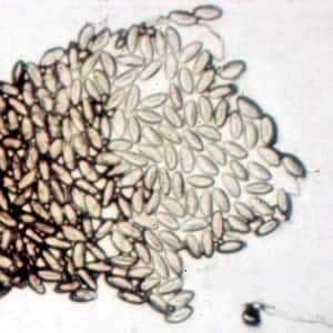 enterobius vermicularis fajta)