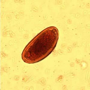 pinworms morfológia a férgek gyógyszere biztonságos