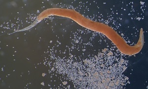 Petefészek enterobiasis Enterobiosis pinworm fejlődési ciklusa