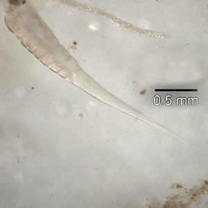 enterobius vermicularis dpdx