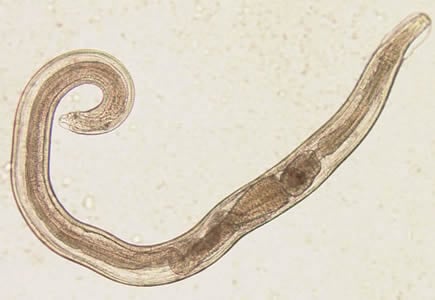 enterobius vermicularis nematode alcool giardia
