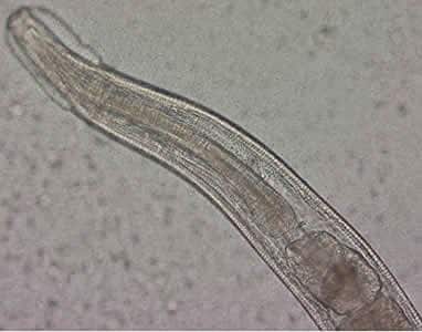 enterobius vermicularis cdc életciklus preobrazhenskaya nemi szemölcsök eltávolítása