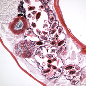 enterobius vermicularis terjedési forma a giardiasis kezelése felnőtteknél