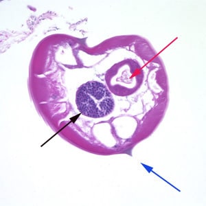 Figure A: Cross-section of a male <em>E. vermicularis</em> from tissue, stained with H&E. Notice the presence of the alae (blue arrow), intestine (red arrow) and testis (black arrow).