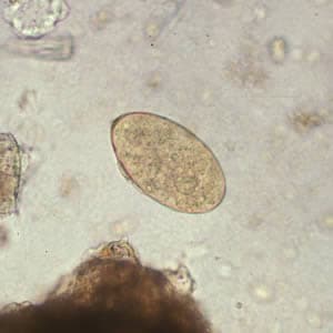 Figure C: Egg of <em>F. hepatica</em> in an unstained wet mount.
