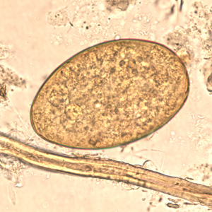 Figure A: Egg of <em>F. buski</em> in a unstained wet mount.