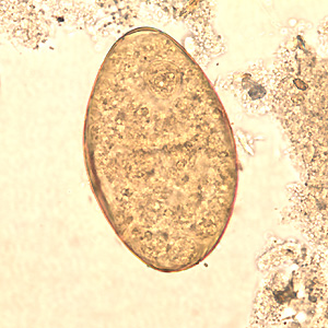 Figure B: Egg of <em>F. buski</em> in a unstained wet mount.