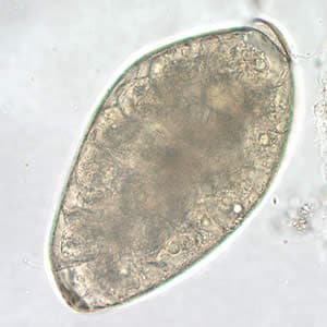 Figure E: Higher magnification (400x) of the egg in Figure D. 