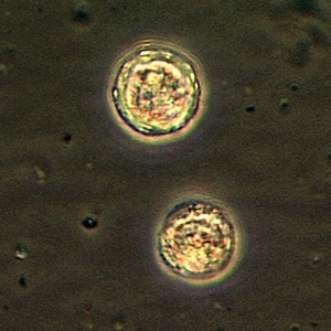 Figure A: Cysts of <em>B. mandrillaris</em>.