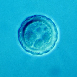 Figure C: Cyst of <em>B. mandrillaris</em>.