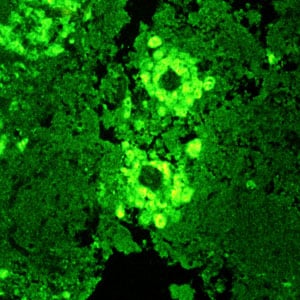 Figure C: IIF of <em>Balamuthia mandrillaris</em> in brain tissue, viewed under UV microscopy.