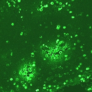 Figure D: IIF of <em>Naegleria fowleri</em> in brain tissue, viewed under UV microscopy. This image was taken at 200x magnification.