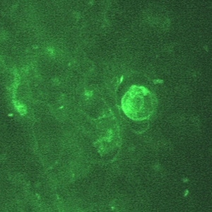 Figure E: IIF of <em>Naegleria fowleri</em> in brain tissue, viewed under UV microscopy. This image was taken at 1000x oil magnification.