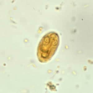 pinworm giardiasis)