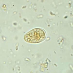 pinworms protozoa
