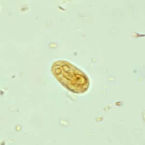 giardia parasite recovery