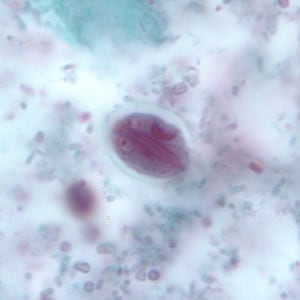 Figure H: <em>G. duodenalis</em> cyst stained with trichrome. Sometimes the cytoplasm of the cyst may retract from the cell wall.